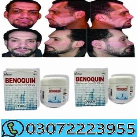 Benoquin cream in pakistan
